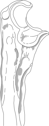 Human hip bone; Anatomy